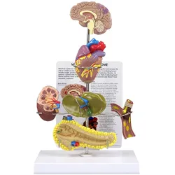 Modell eines metabolischen Syndroms