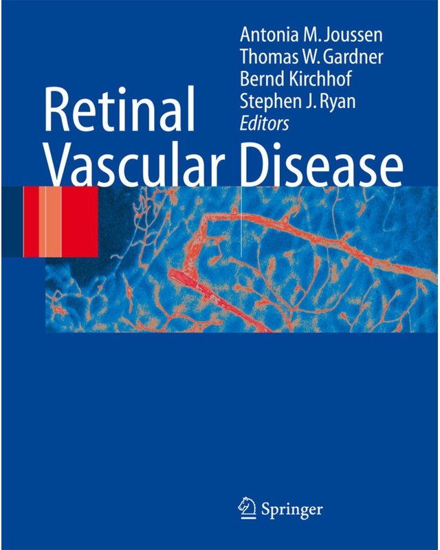 Retinal Vascular Disease, Kartoniert (TB)