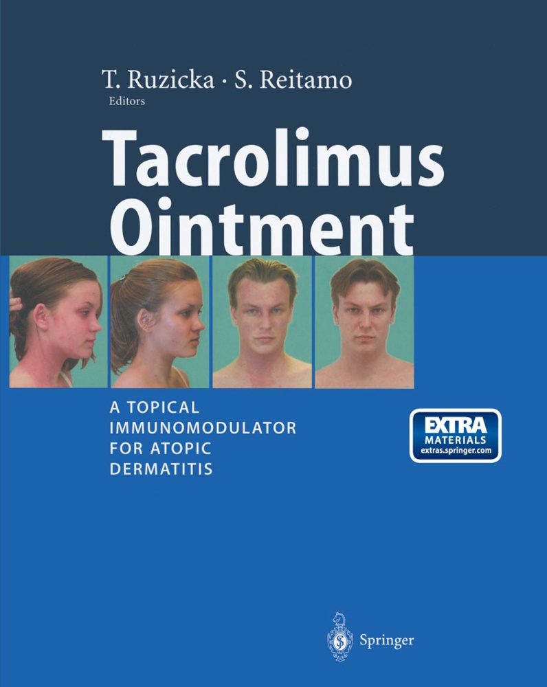 Tacrolimus Ointment  Kartoniert (TB)