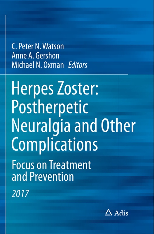 Herpes Zoster: Postherpetic Neuralgia And Other Complications, Kartoniert (TB)