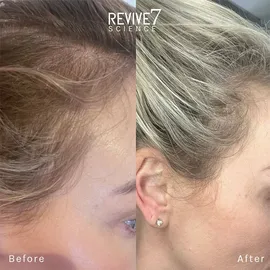 revive7 - Hair Treatment 30 ml