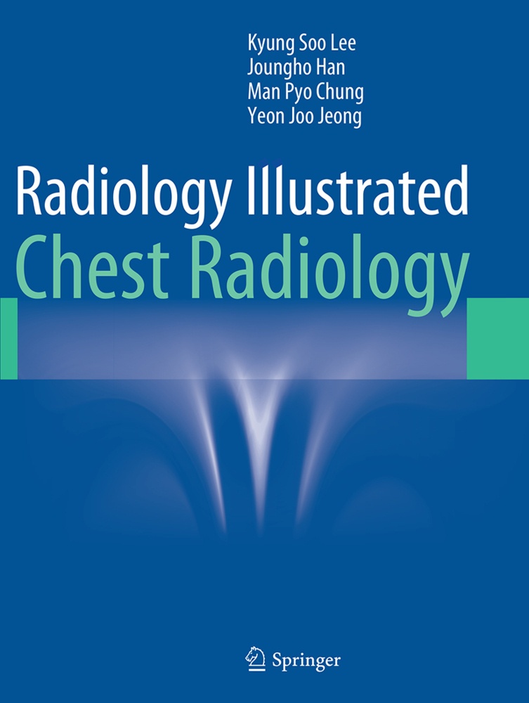 Radiology Illustrated: Chest Radiology - Kyung Soo Lee  Joungho Han  Man Pyo Chung  Yeon Joo Jeong  Kartoniert (TB)