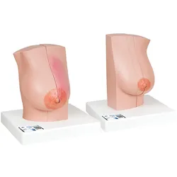 Weibliches Brustmodell - 3B Smart Anatomy