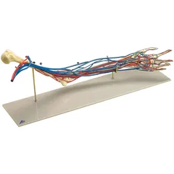 Gefäß-Arm