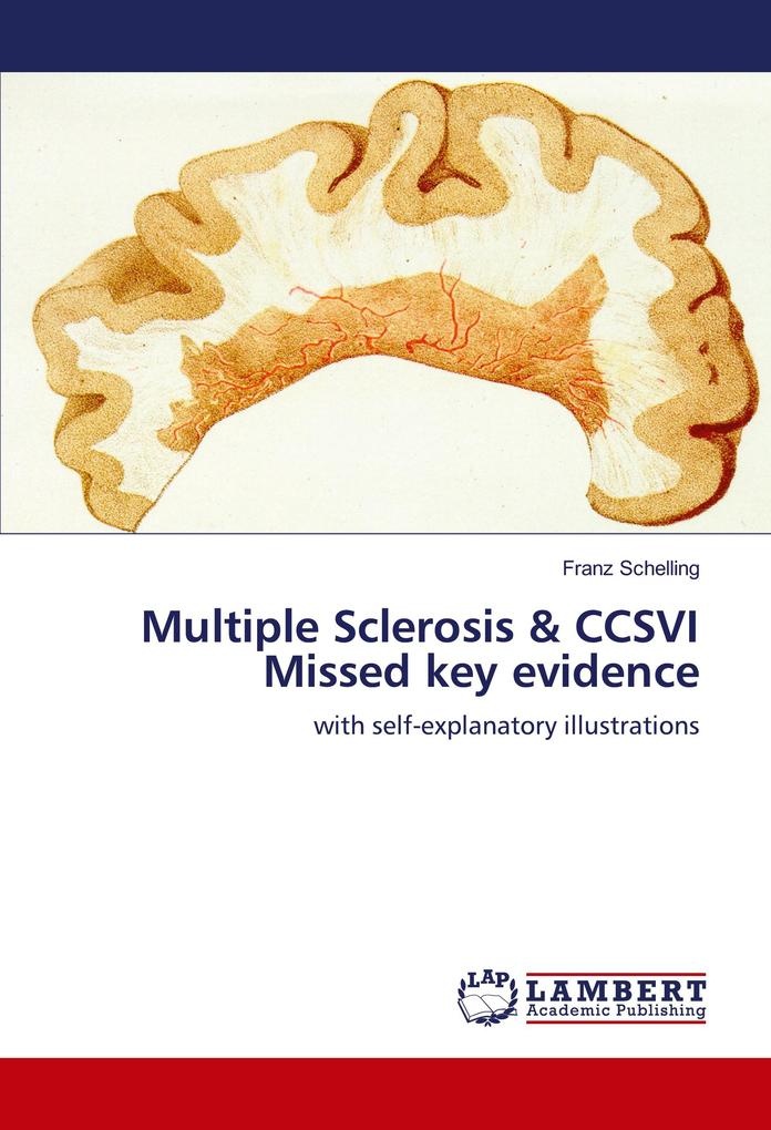 Multiple Sclerosis & CCSVI Missed key evidence: Buch von Franz Schelling
