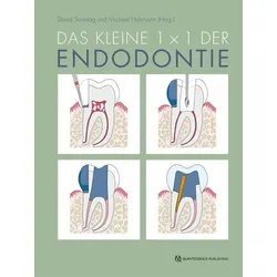 Das kleine 1x1 der Endodontie