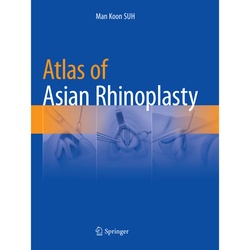 Atlas Of Asian Rhinoplasty - Man Koon SUH, Kartoniert (TB)