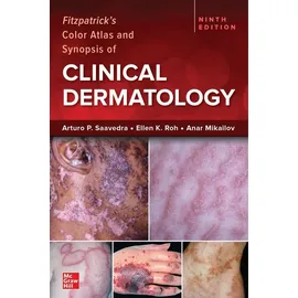 McGraw-Hill Education Fitzpatrick's Color Atlas and Synopsis of Clinical Dermatology, Ninth Edition