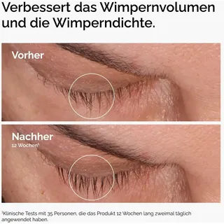 The Ordinary Multi-Peptide Lash and Brow Serum 5 ml