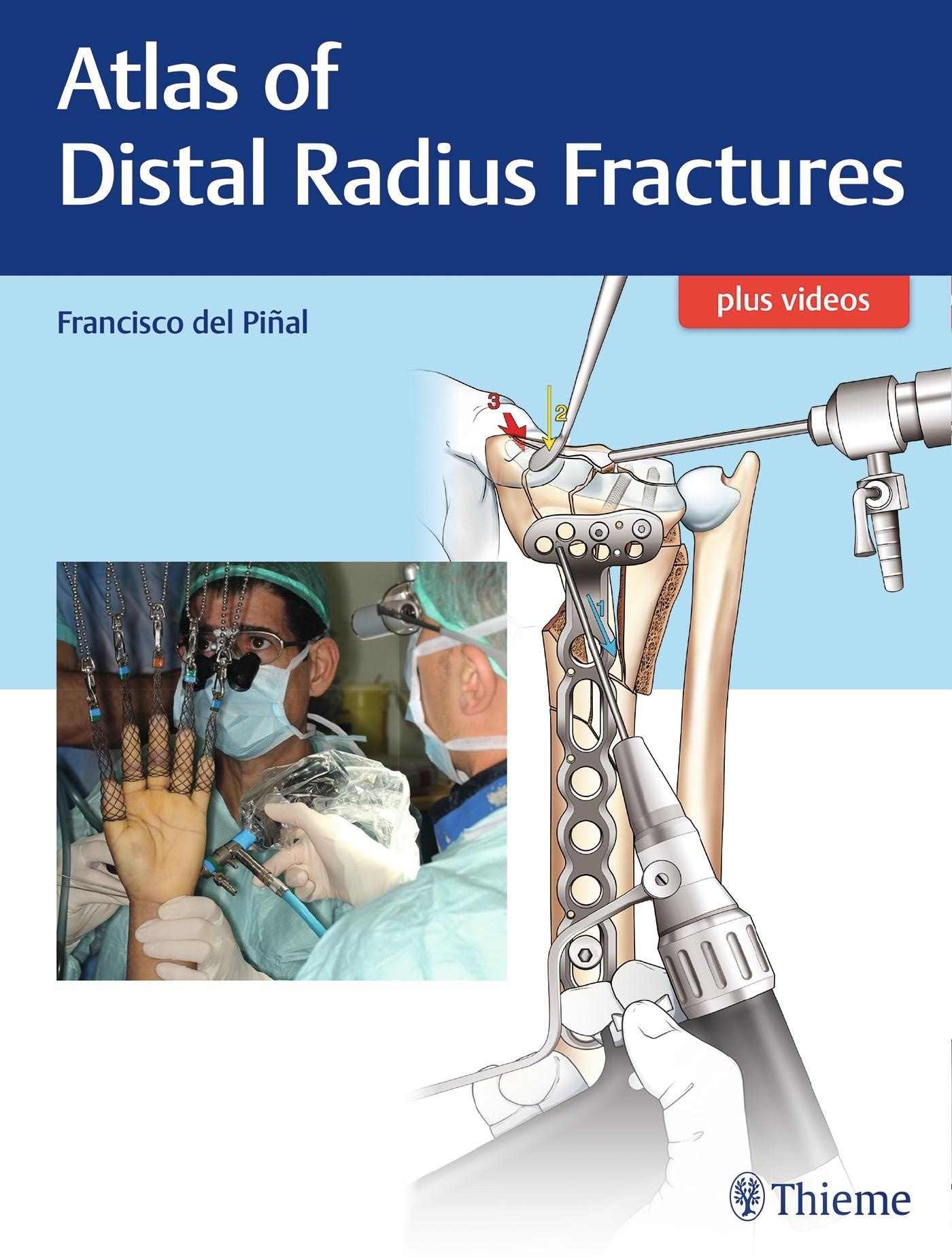 Atlas Of Distal Radius Fractures - Francisco del Piñal  Gebunden