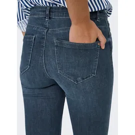 Only "ONLWAUW LIFE MID SK DNM", Damen, Gr. M (38), Länge 30, blau (blau schwarz denim), Denim/Jeans, Obermaterial: 64% Baumwolle, 31% Polyester, 3% Viskose, 2% Elasthan, unifarben, skinny fit, Jeans 5-Pocket-Jeans