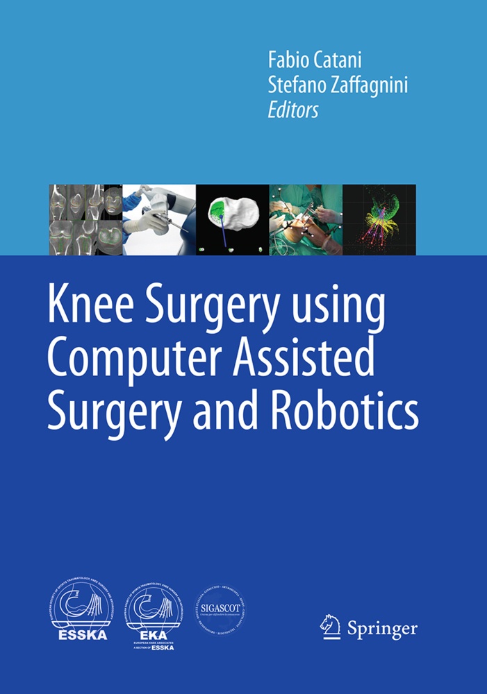 Knee Surgery Using Computer Assisted Surgery And Robotics  Kartoniert (TB)