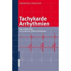 Tachykarde Arrhythmien