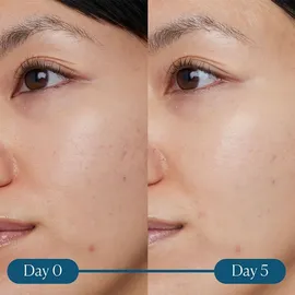 ELEMIS Dynamic Resurfacing Super-C Serum 30 ml