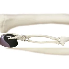 Evoluent VerticalMouse 4 Right Wireless schwarz/blau