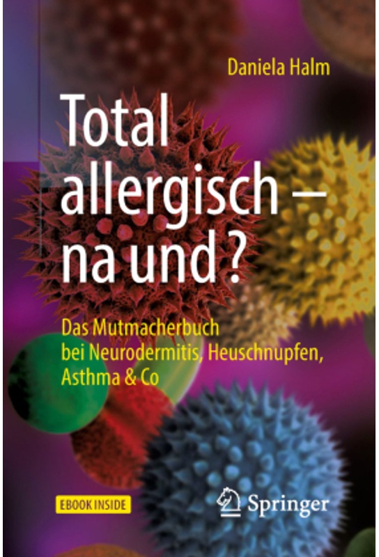 Total Allergisch - Na Und?, M. 1 Buch, M. 1 E-Book - Daniela Halm, Kartoniert (TB)