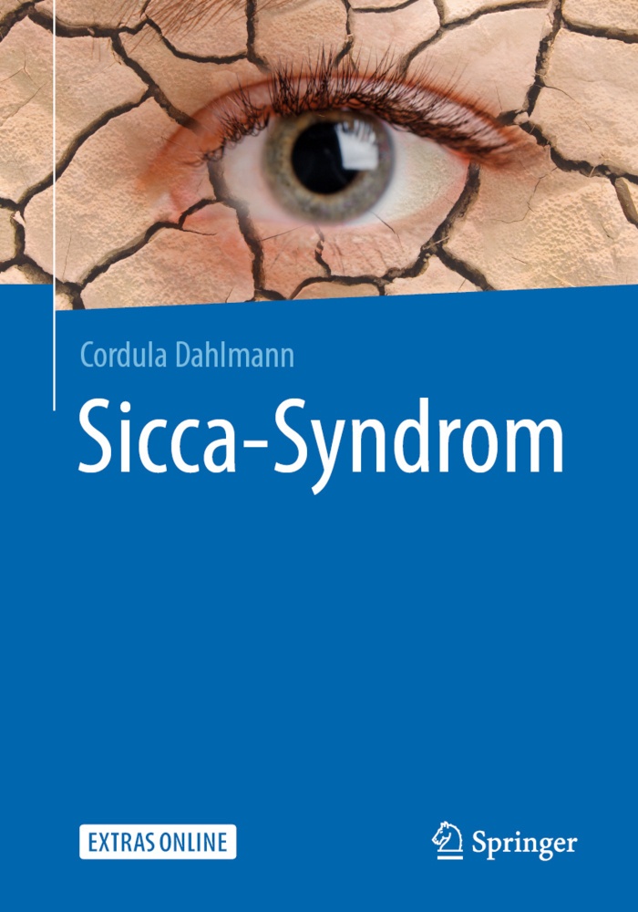 Sicca-Syndrom - Cordula Dahlmann  Kartoniert (TB)