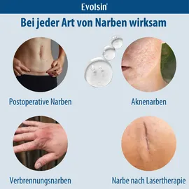 Evolsin medical UG (haftungsbeschränkt) Evolsin Narben Gel