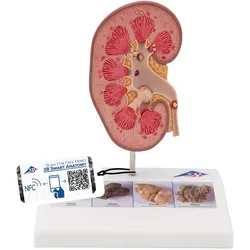 Nierensteinmodell - 3B Smart Anatomy