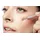 remos professional body care REMOS Komedonenquetscher/Pickelentferner mit 2 Schlingen Edelstahl rostfrei 10 cm