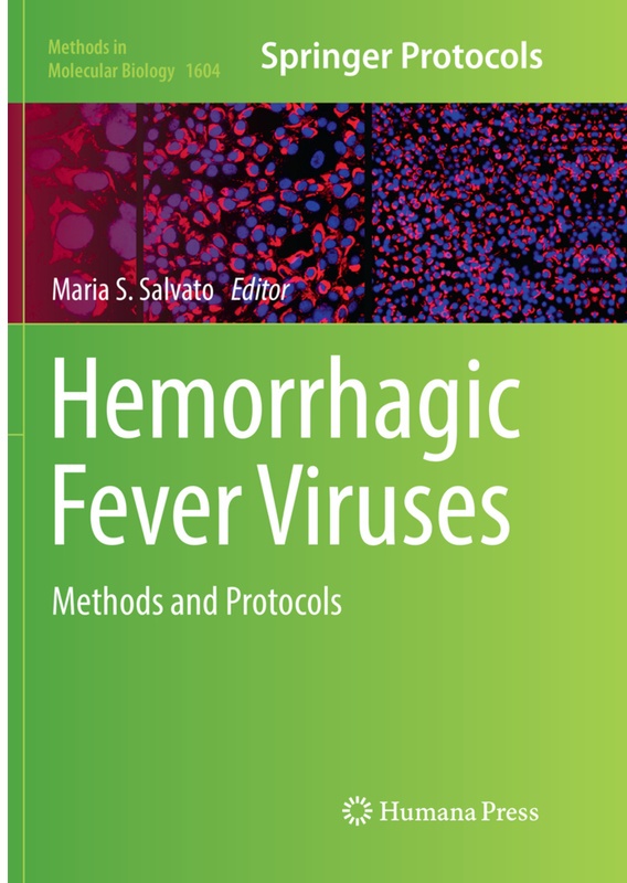 Hemorrhagic Fever Viruses  Kartoniert (TB)