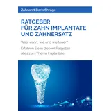Independently published RATGEBER FÜR ZAHN IMPLANTATE UND ZAHNERSATZ: Was, wann, wie und wie teuer? Erfahren Sie in diesem Ratgeber alles zum Thema Implantate.