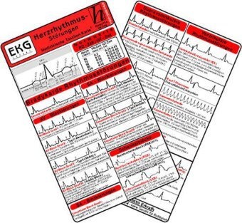 Herzrhythmusstörungen - Medizinische Taschen-Karte  Gebunden