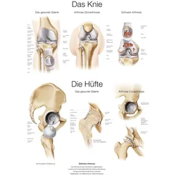 Lehrtafel Das Knie / Die Hüfte (deutsch) 70x100cm