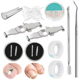 152 Pcs Nagelspange FußNäGel,Eingewachsene ZehennäGel Set,Zehennagel Eingewachsen,Nagelspange FußNäGel,Zehennagel Korrektur,Ingrown Toenail,Zehennagel Spange,Nagelspange