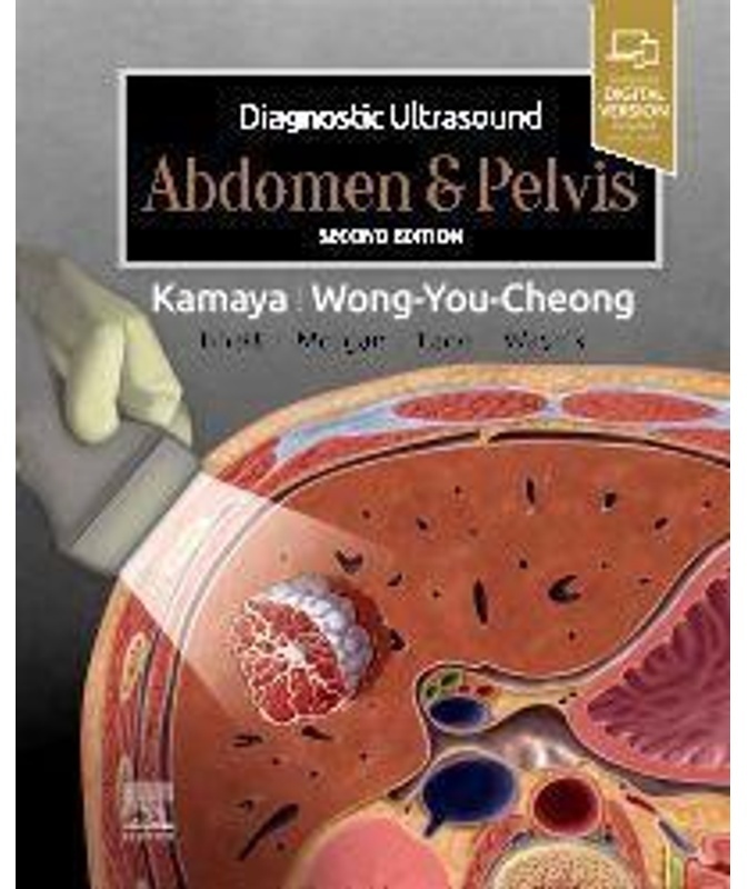 Diagnostic Ultrasound: Abdomen And Pelvis - Aya Kamaya, Jade Wong-You-Cheong, Gebunden