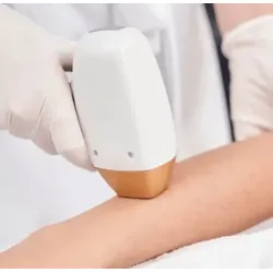 Diodenlaser - Unterarme