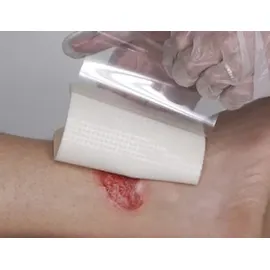 Urgo Verband 10 x 12 cm 20 St.