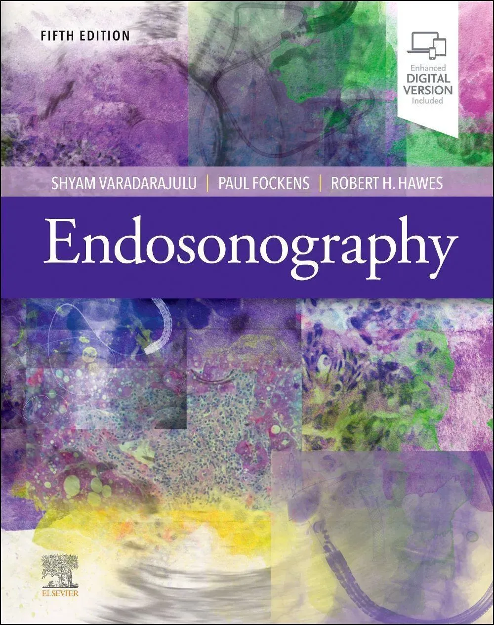 Endosonography  Gebunden