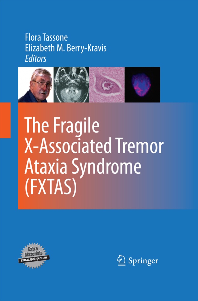 The Fragile X-Associated Tremor Ataxia Syndrome (Fxtas)  Kartoniert (TB)