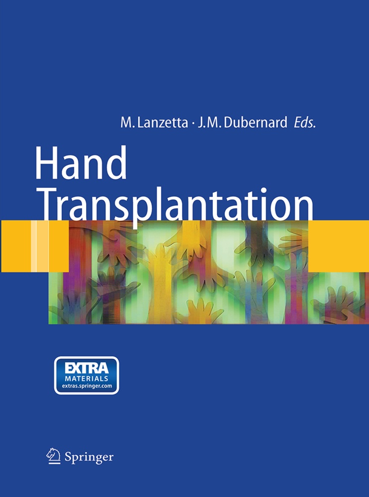 Hand Transplantation  Kartoniert (TB)