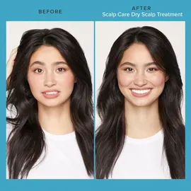 Living Proof Scalp Care Dry Scalp Treatment Konzentrat 100 ml