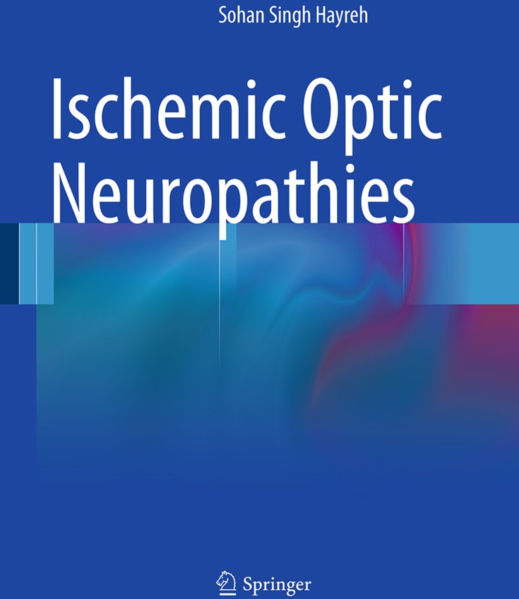 Ischemic Optic Neuropathies - Sohan S. Hayreh  Kartoniert (TB)