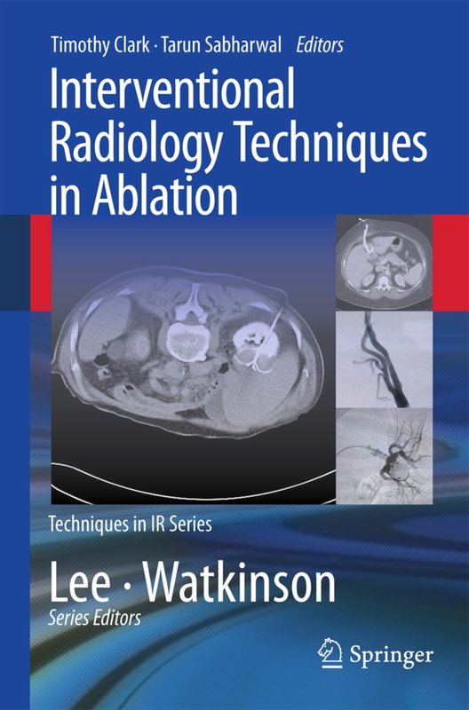 Interventional Radiology Techniques In Ablation, Kartoniert (TB)