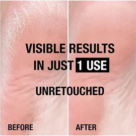 Neutrogena Norwegische Formel Intense Repair Foot Cream 50 ml