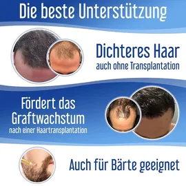 hairforte Spray 3% Procapil gegen Haarverlust DHT Blocker